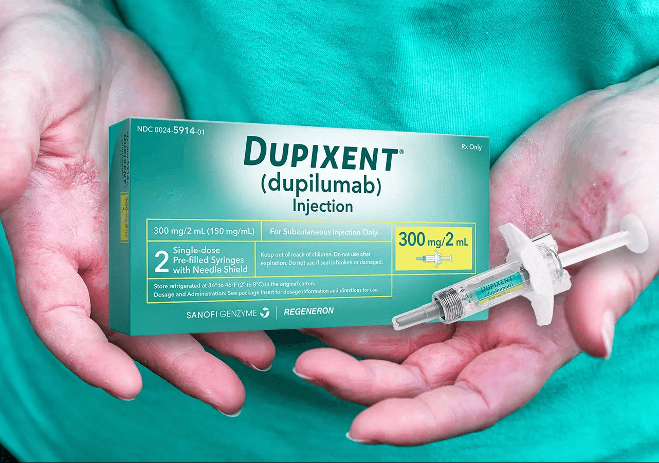 Como Conseguir o Medicamento Dupilumabe Dupixent pelo SUS: Guia Completo